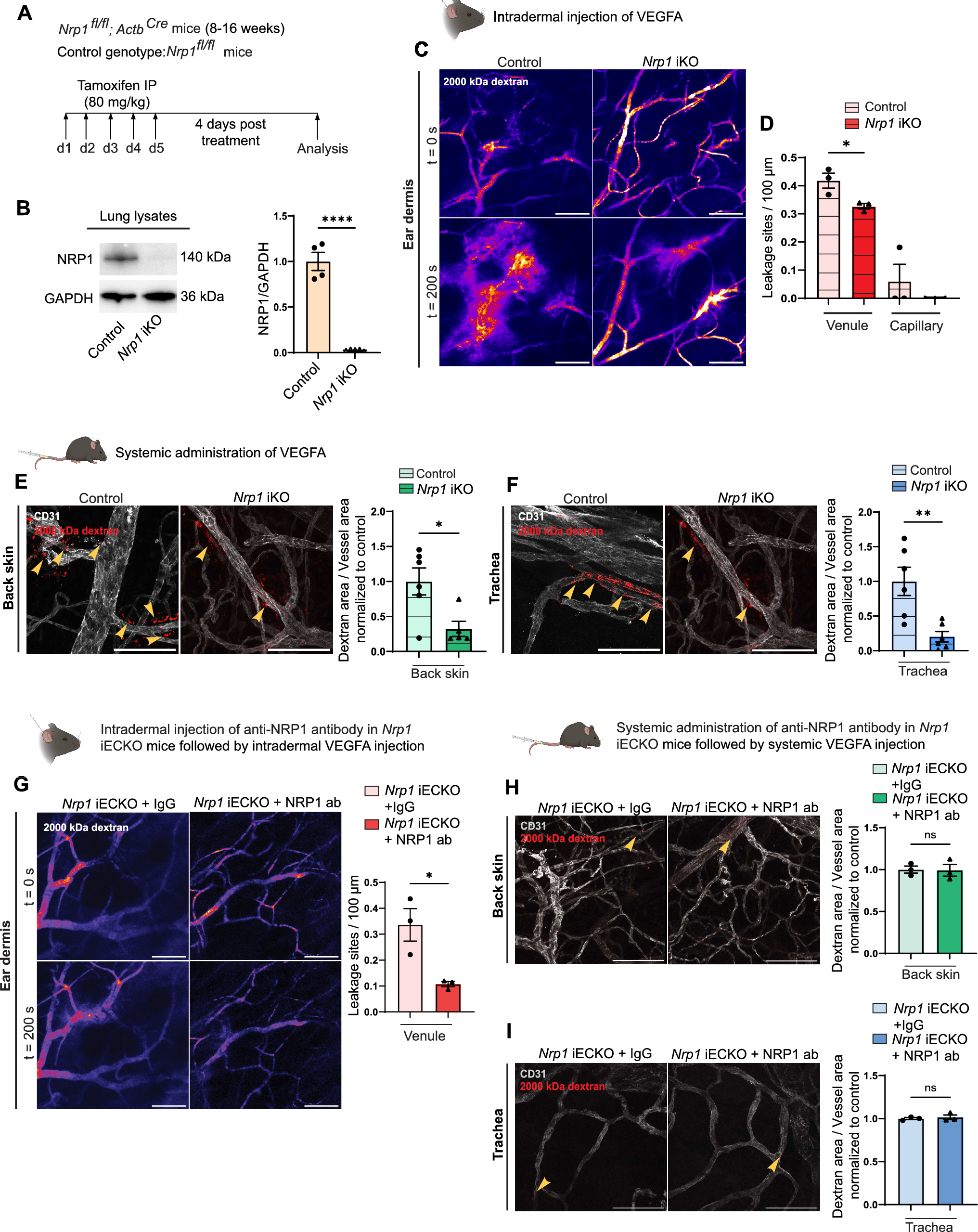 Correction: Neuropilin-1 controls vascular permeability through juxtacrine regulation of endothelial adherens junctions