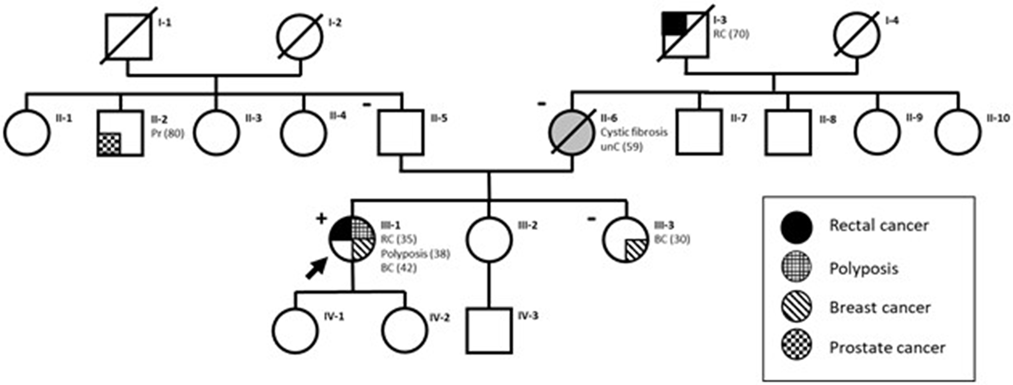 New  gene variant in colorectal cancer diagnosis: insight from a large series of patients
