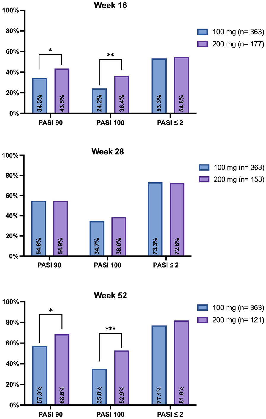 Optimizing Tildrakizumab Dosing in Psoriasis: A 52-Week Multicenter Retrospective Study Comparing 100 mg and 200 mg—IL PSO (Italian Landscape Psoriasis)