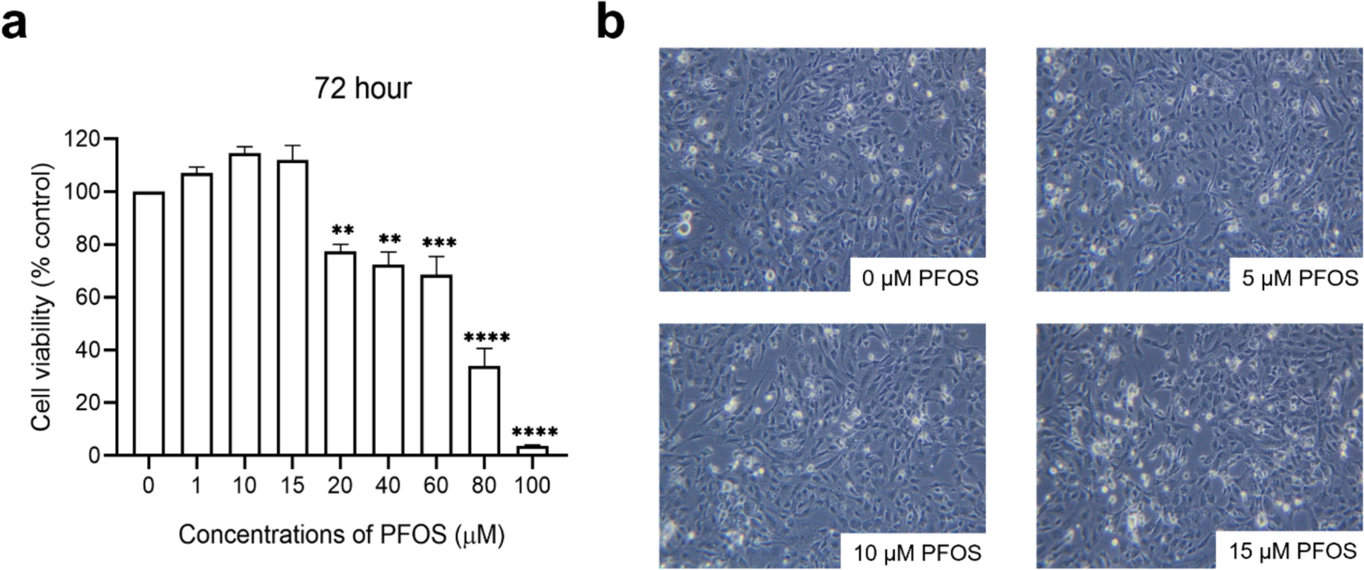 Perfluorooctane sulfonic acid: a possible risk factor of endothelial dysfunction based on in silico and in vitro studies
