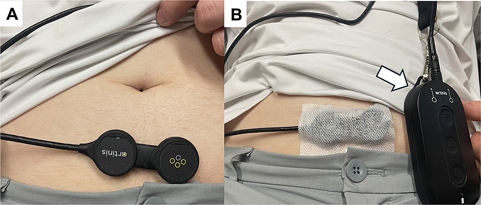 New Imaging Techniques on the Horizon to Study Overactive and Neurogenic Bladder