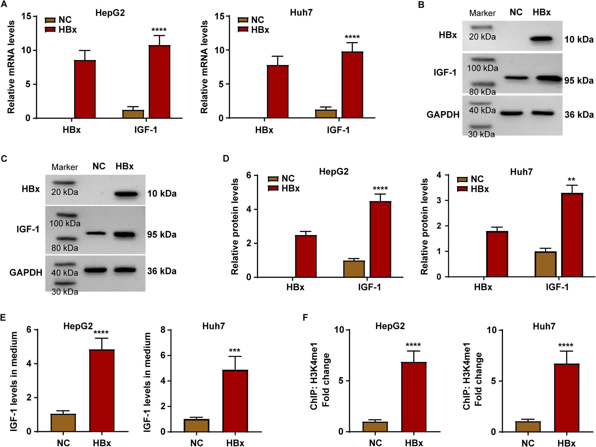 HBx/WDR5 enhances IGF-1 transcription in hepatocellular carcinoma cells and promotes recruitment, infiltration, and activity of Treg cells
