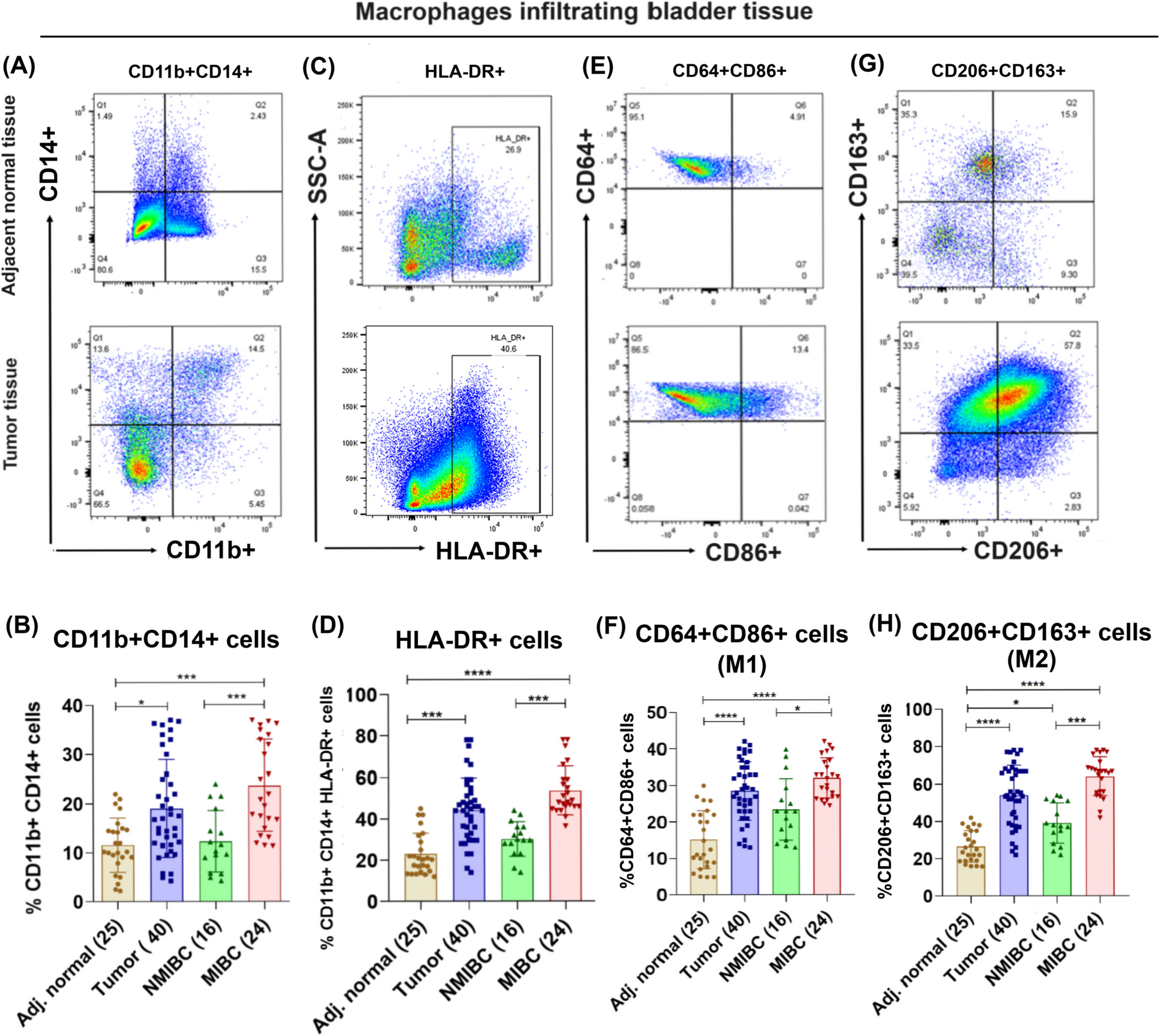 Phenotypic characterization of tumor associated macrophages and circulating monocytes in patients with Urothelial carcinoma of bladder