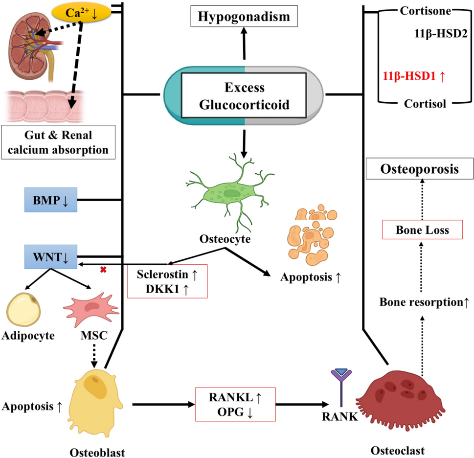 Molecular mechanisms and treatment strategies for estrogen deficiency-related and glucocorticoid-induced osteoporosis: a comprehensive review
