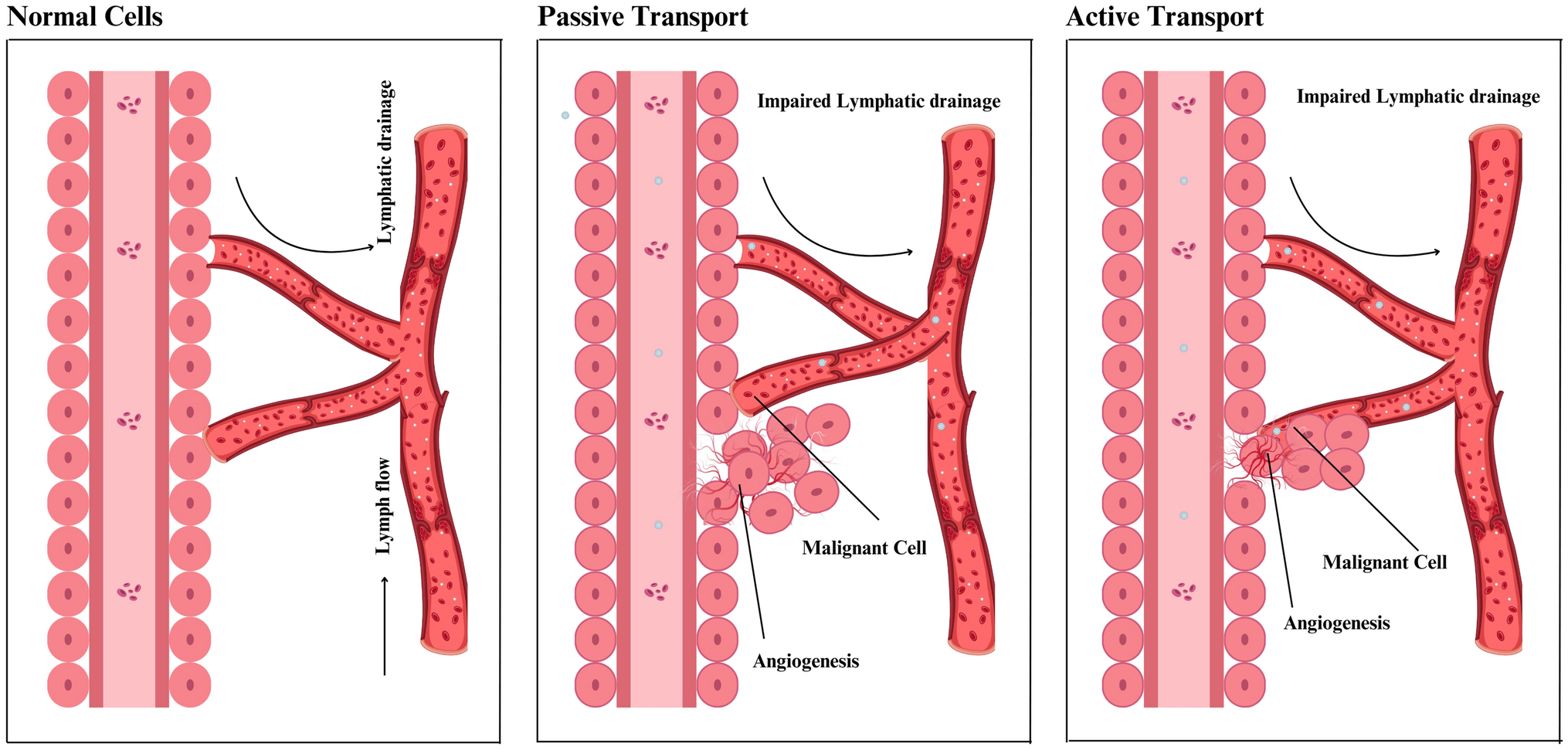 NSAID-encapsulated nanoparticles as a targeted therapeutic platform for modulating chronic inflammation and inhibiting cancer progression: a review