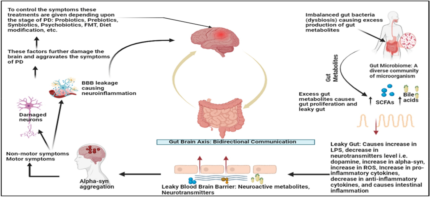 Gut microbiota and Parkinson’s Disease: a new frontier in understanding neurological health