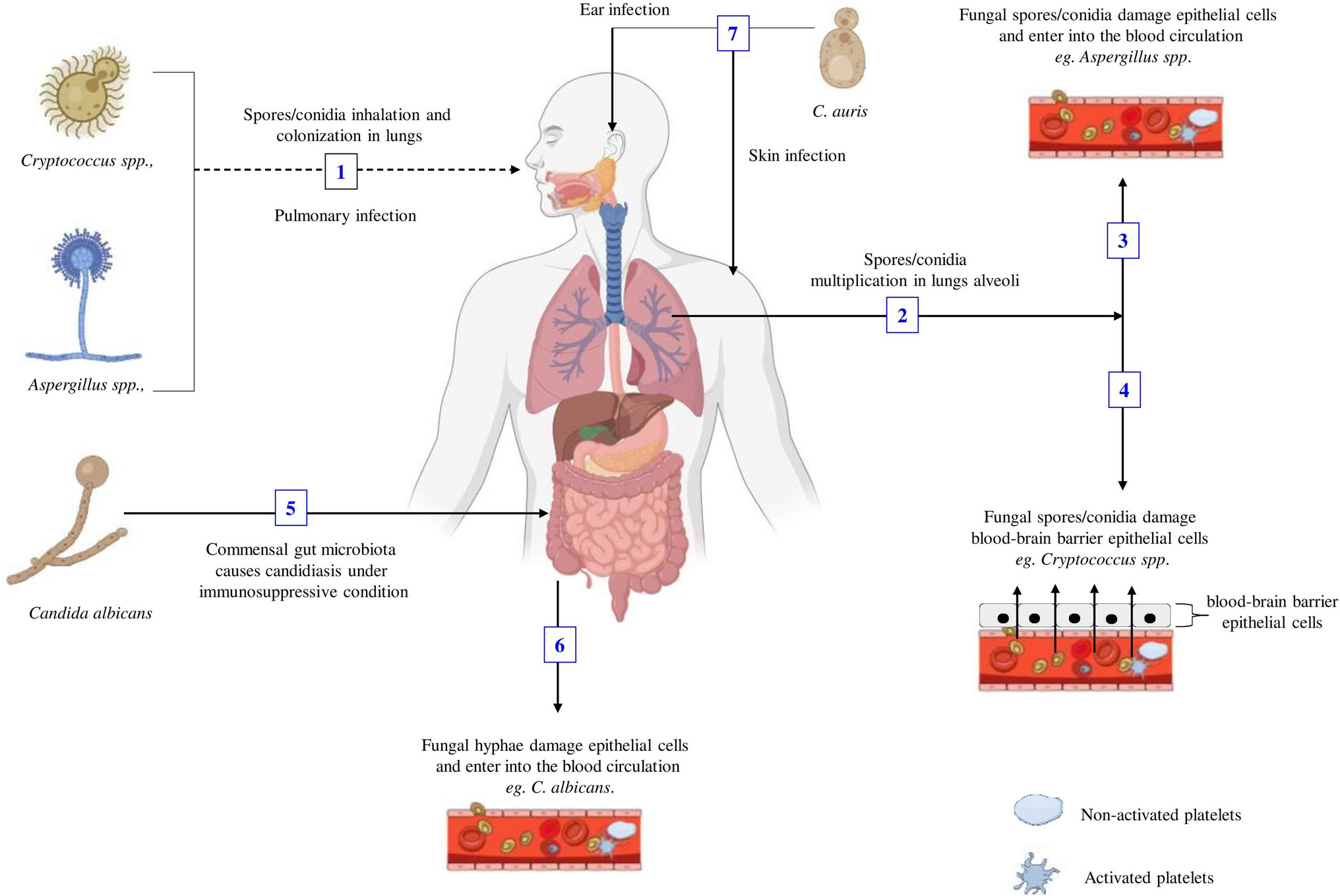 Molecular Insights Into the Interplay Between Host Platelets and Fungal Pathogens
