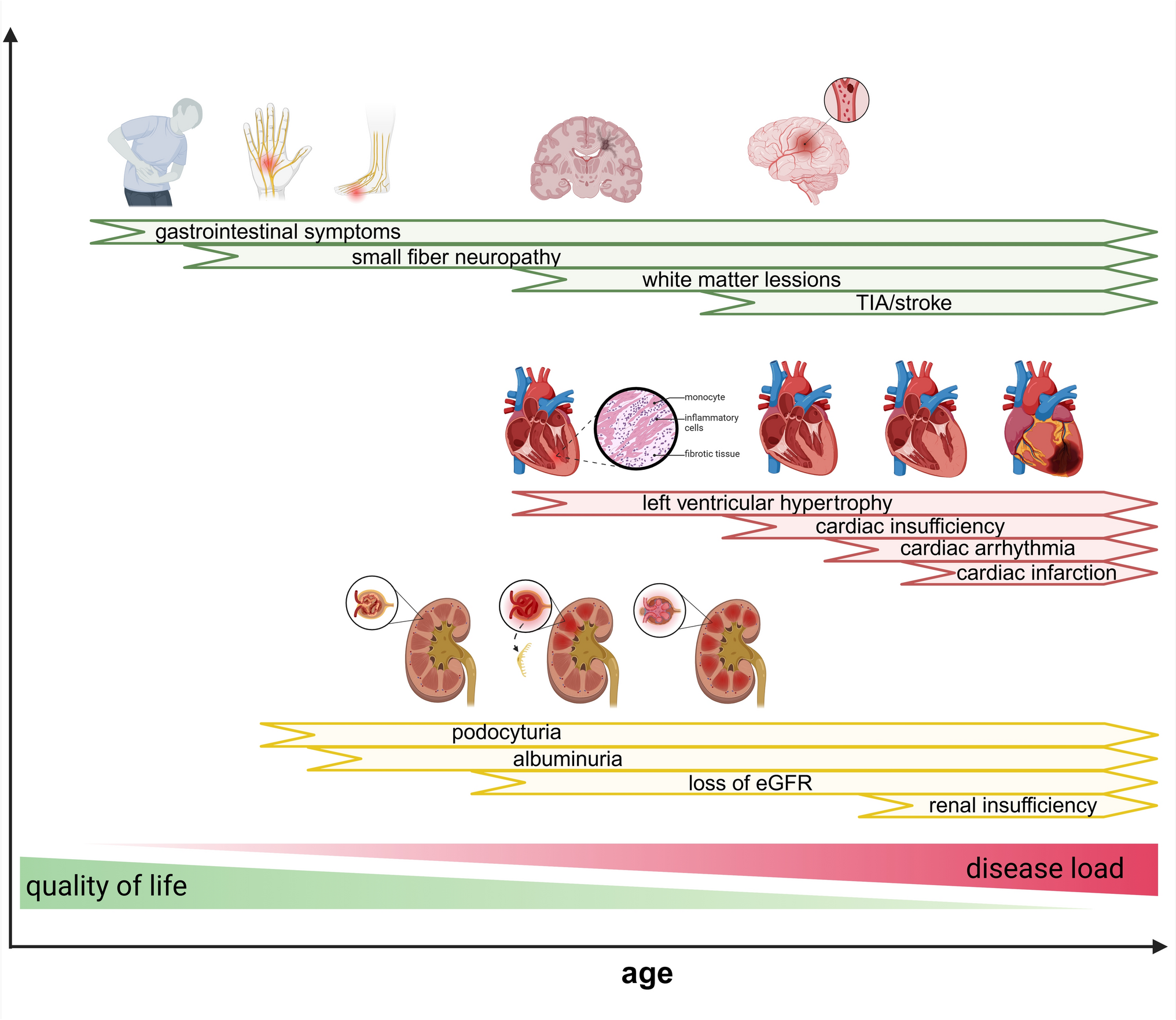 Progress and Challenges in the Treatment of Fabry Disease