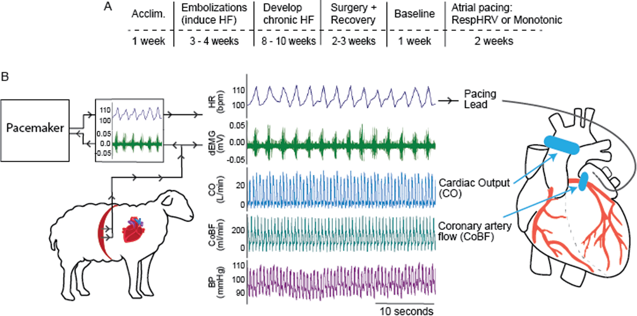 Reinstating respiratory heart rate variability improves hemodynamic responses during exercise in heart failure with reduced ejection fraction