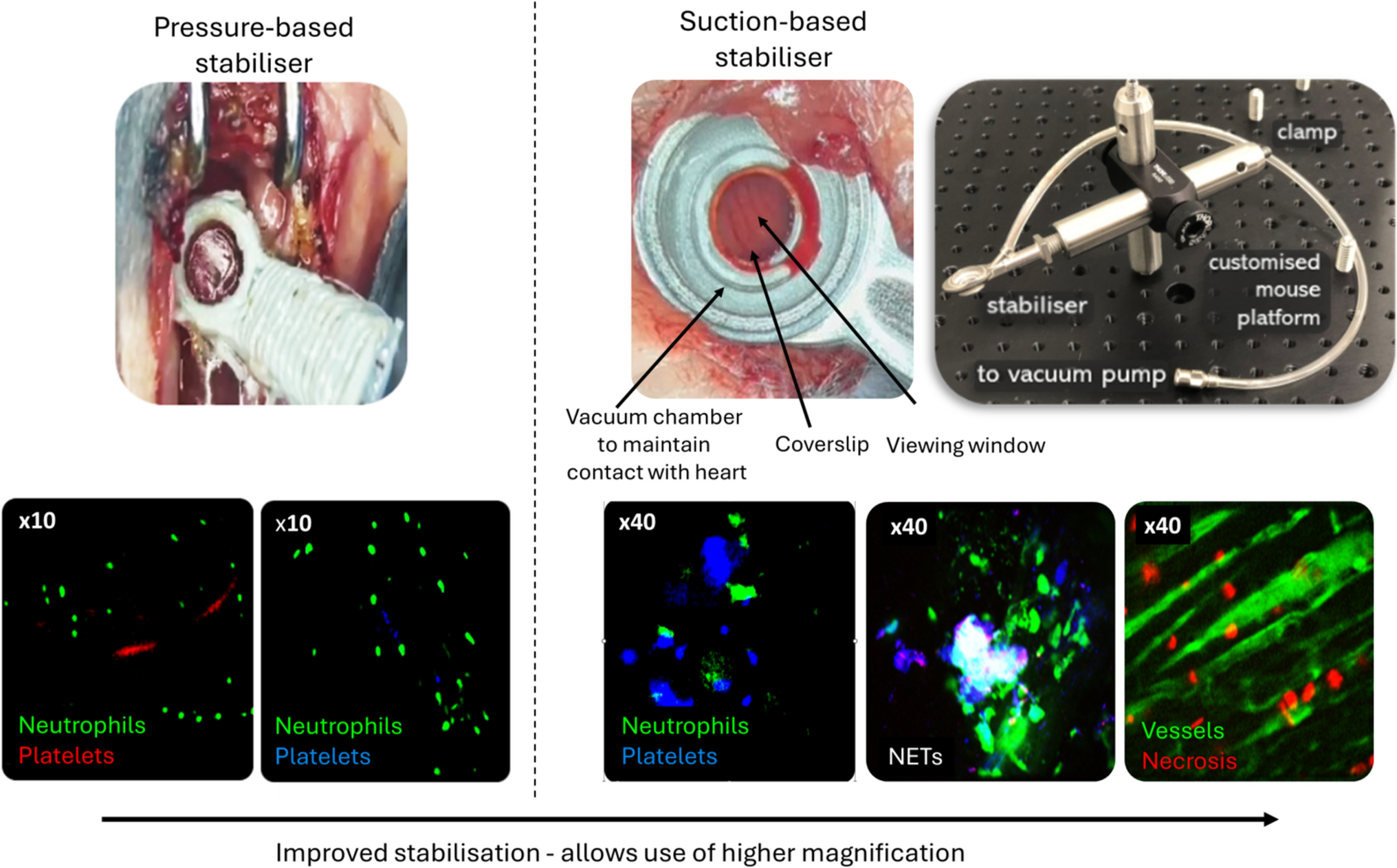Impact of chronic hyperglycaemia on the coronary microcirculation – benefits of targeting IL-36 and diet reversal