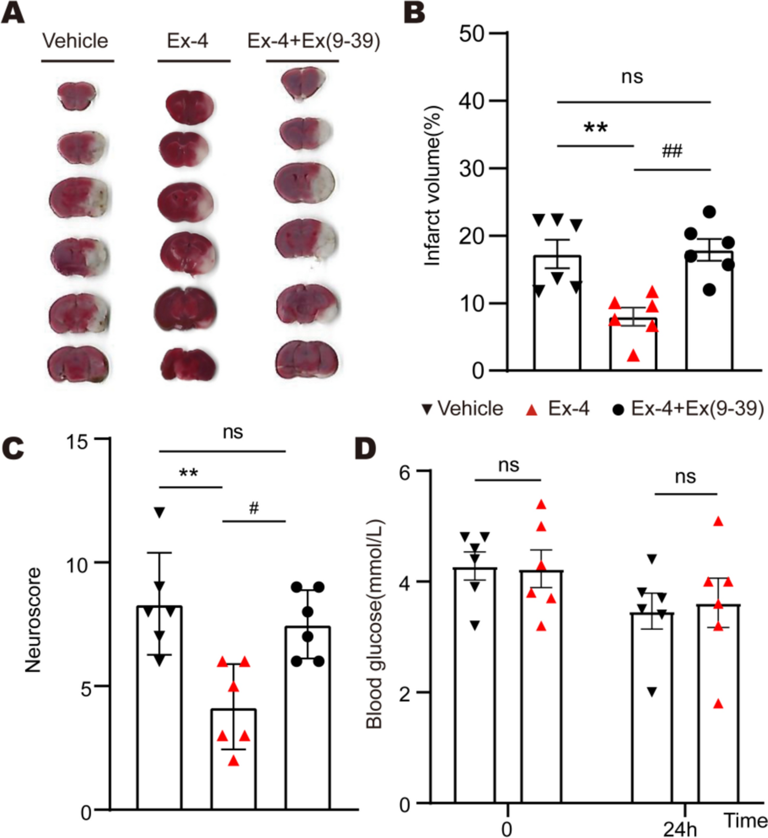 Exendin-4 improves cerebral ischemia by relaxing microvessels, rapidly increasing cerebral blood flow after reperfusion