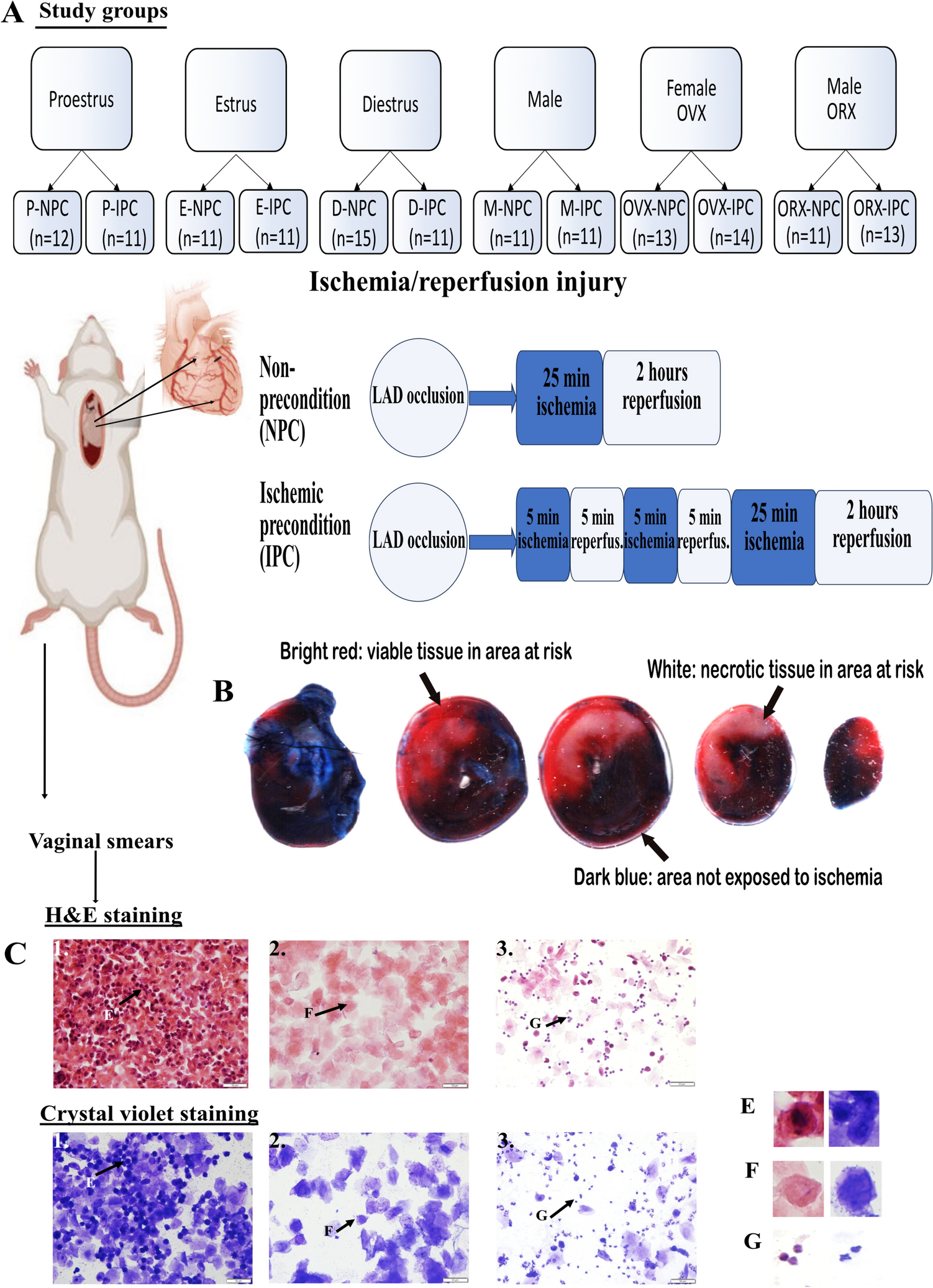 Associations between female sex hormones, estrous cycle, ischemic preconditioning and myocardial infarct size after ischemia–reperfusion injury