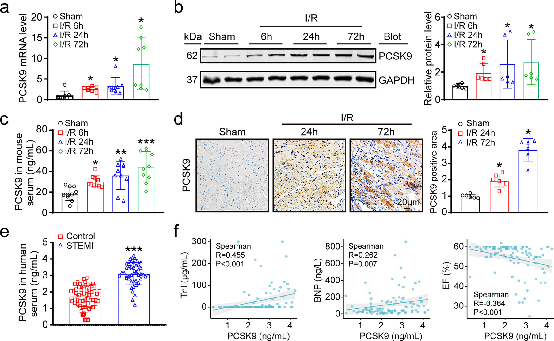 Evolocumab attenuates myocardial ischemia/reperfusion injury by blocking PCSK9/LIAS-mediated cuproptosis of cardiomyocytes
