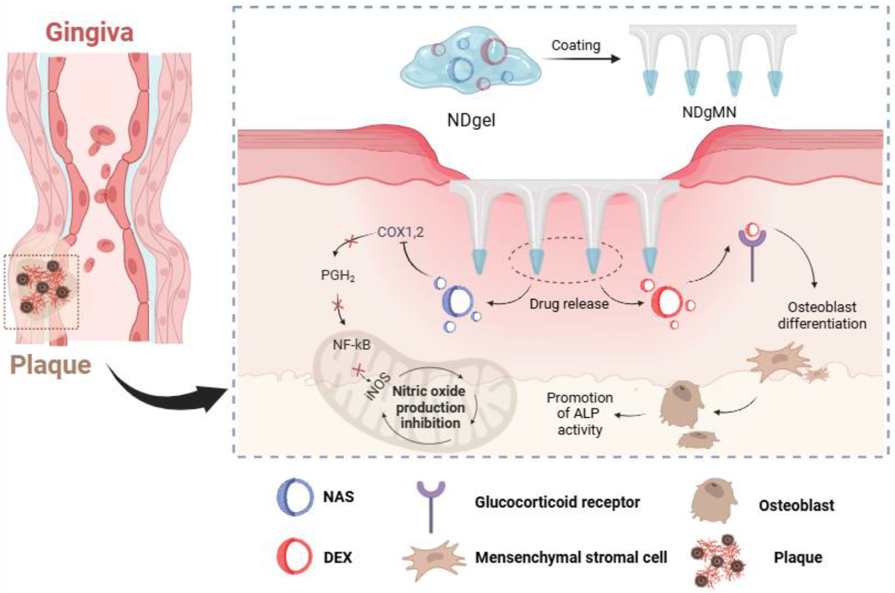 Buccal application of microneedles coated with an optimized hydrogel containing naproxen and dexamethasone