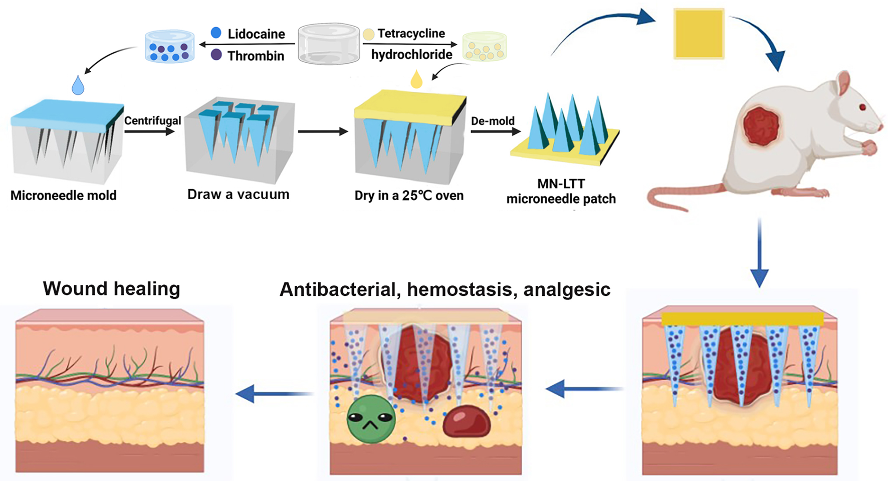 Biodegradable multifunctional hyaluronic acid hydrogel microneedle band-aids for accelerating skin wound healing