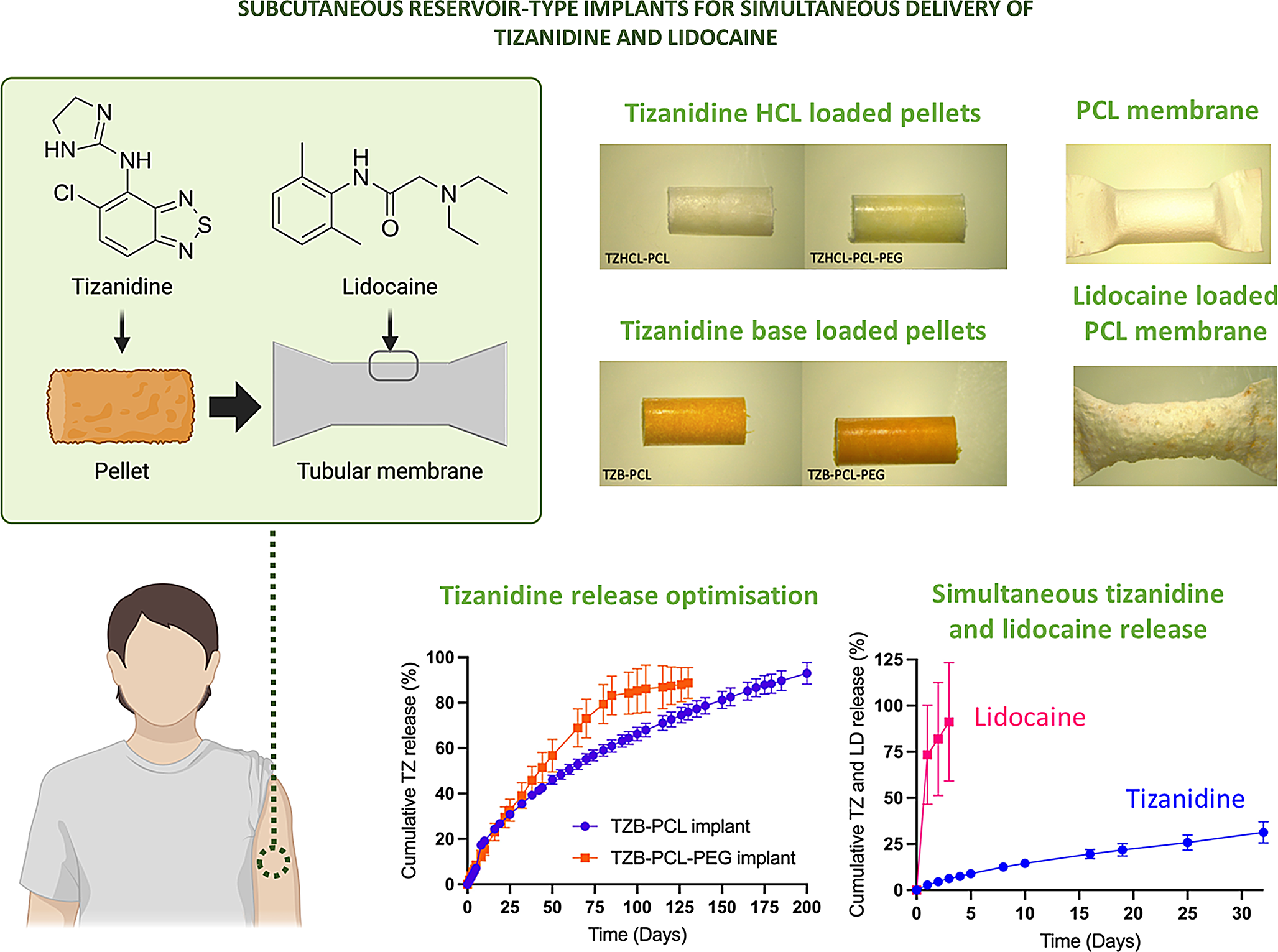 Preparation, characterisation, and testing of reservoir-based implantable devices loaded with tizanidine and lidocaine