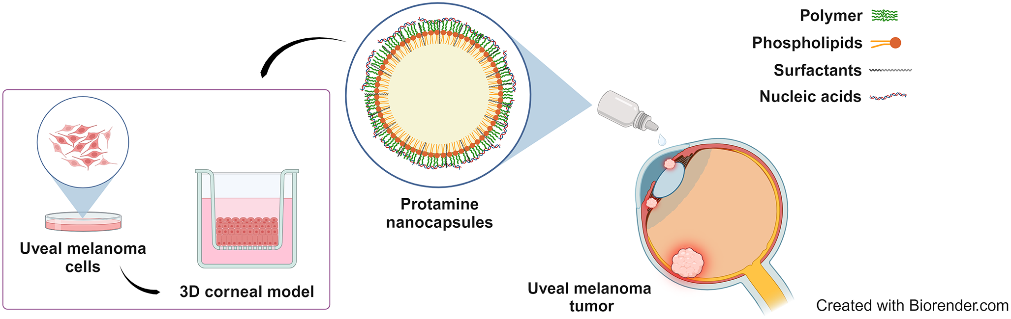 Protamine nanocapsules as gene delivery carriers for the treatment of intraocular tumors