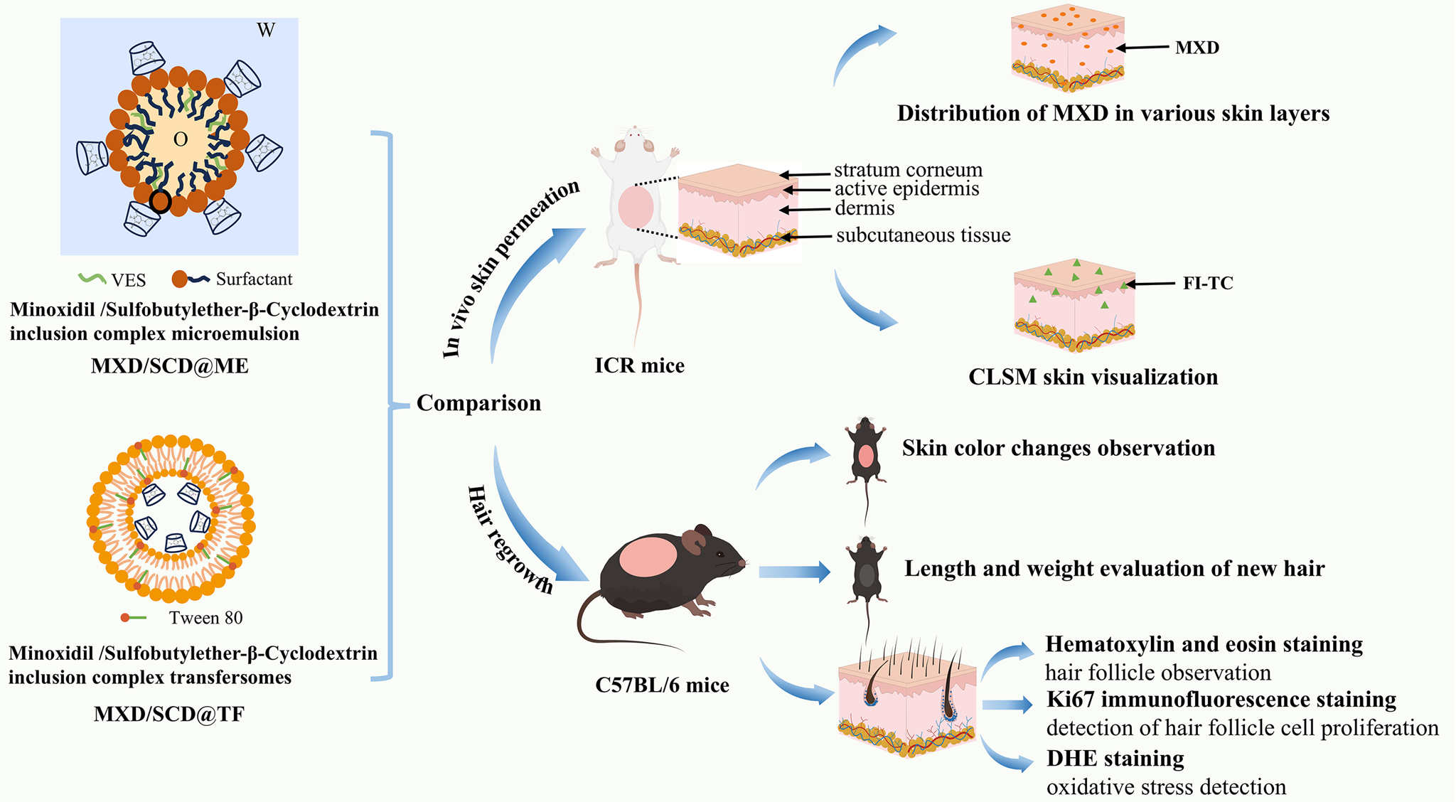 Minoxidil cyclodextrin inclusion complex-loaded microemulsions and transfersomes for androgen alopecia treatment: a comparative study