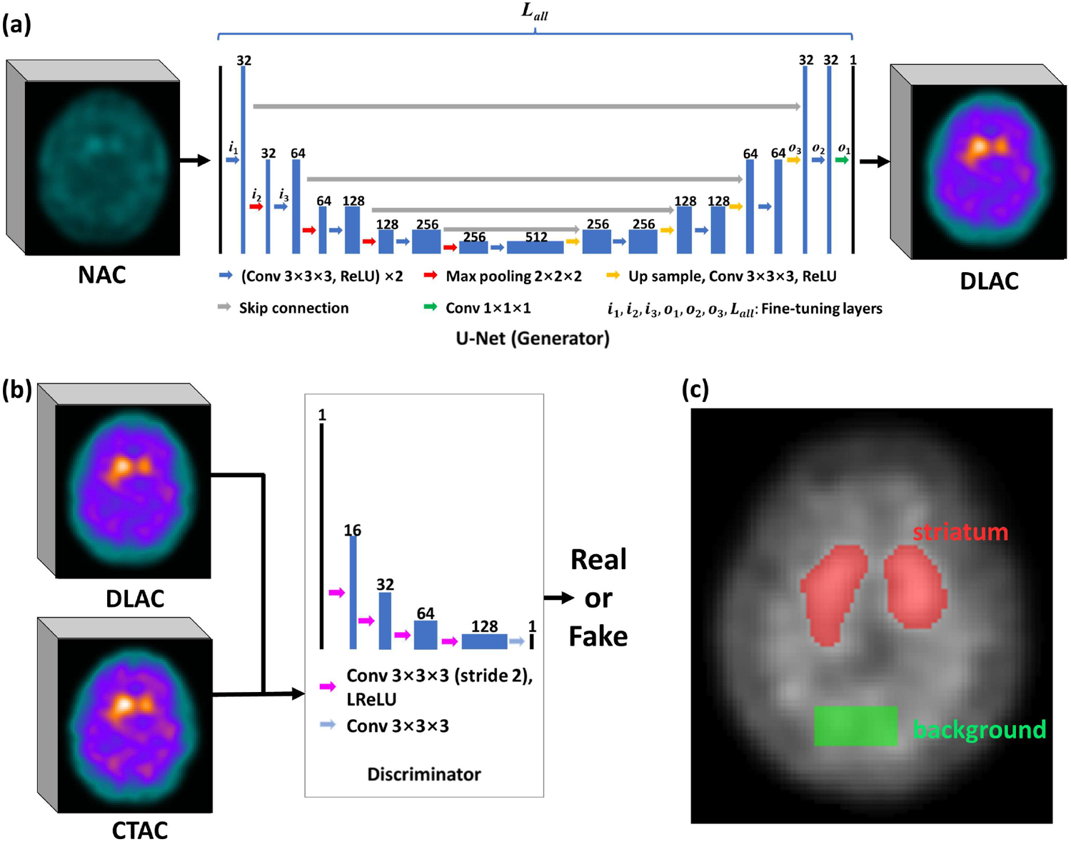 Transfer learning‑based attenuation correction in 99mTc-TRODAT-1 SPECT for Parkinson’s disease using realistic simulation and clinical data