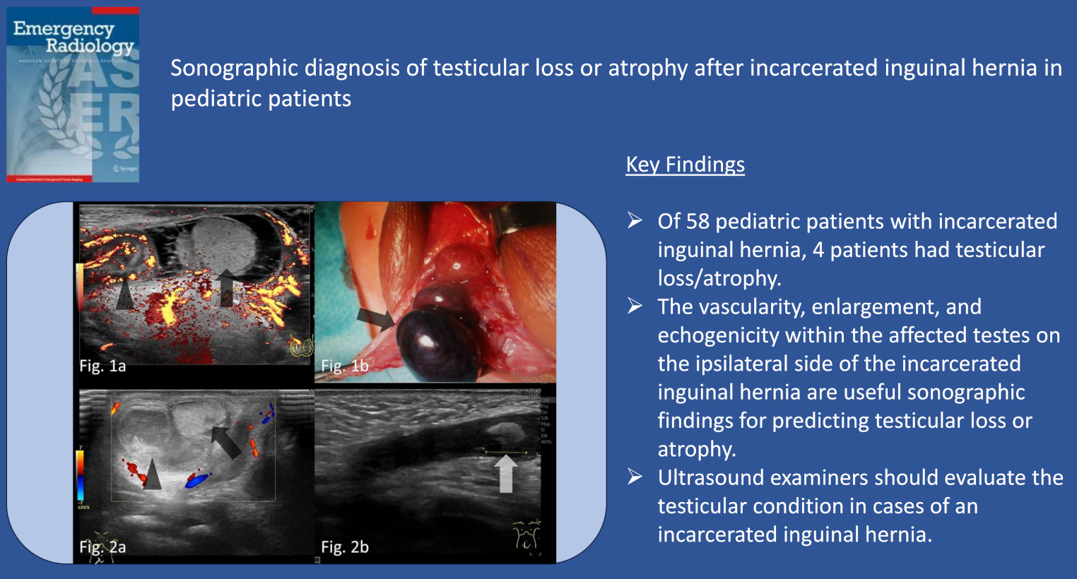 Sonographic diagnosis of testicular loss or atrophy after incarcerated inguinal hernia in pediatric patients
