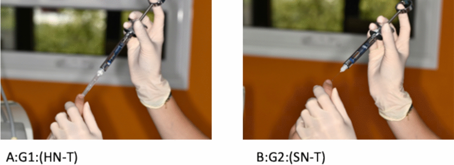The effect of needle demonstration during local anaesthesia on the child’s dental fear, pain perception and behaviour: a randomised controlled trial
