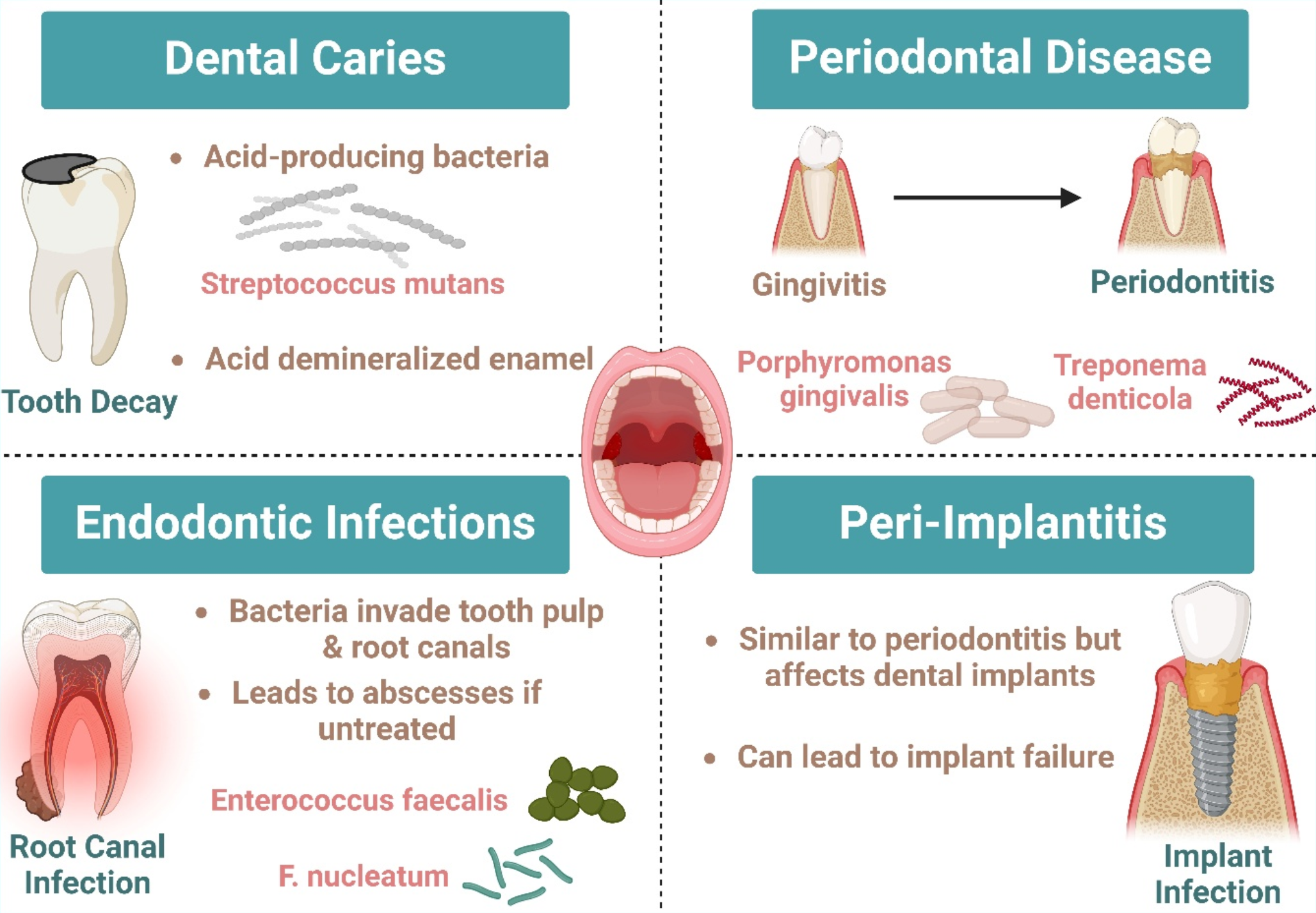 When oral health affects overall health: biofilms, dental infections, and emerging antimicrobial strategies