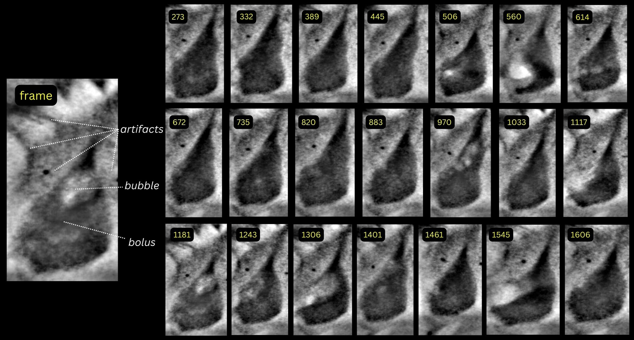 A Machine Learning Pipeline for Automated Bolus Segmentation and Area Measurement in Swallowing Videofluoroscopy Images of an Infant Pig Model