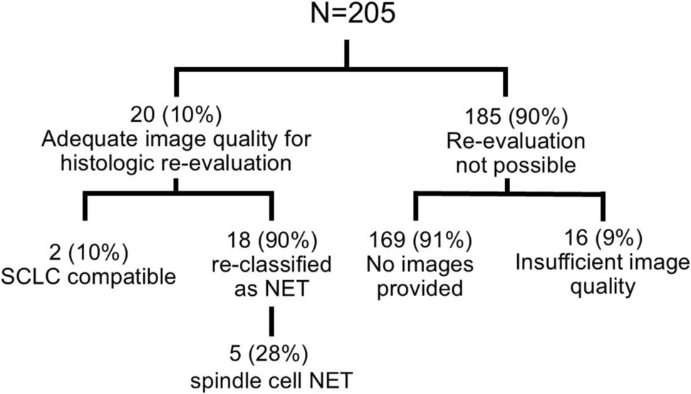 Is Ectopic Cushing Syndrome Commonly Associated with Small Cell Lung Cancer (SCLC)? Critical Review of the Literature and ACTH Expression in Resected SCLC