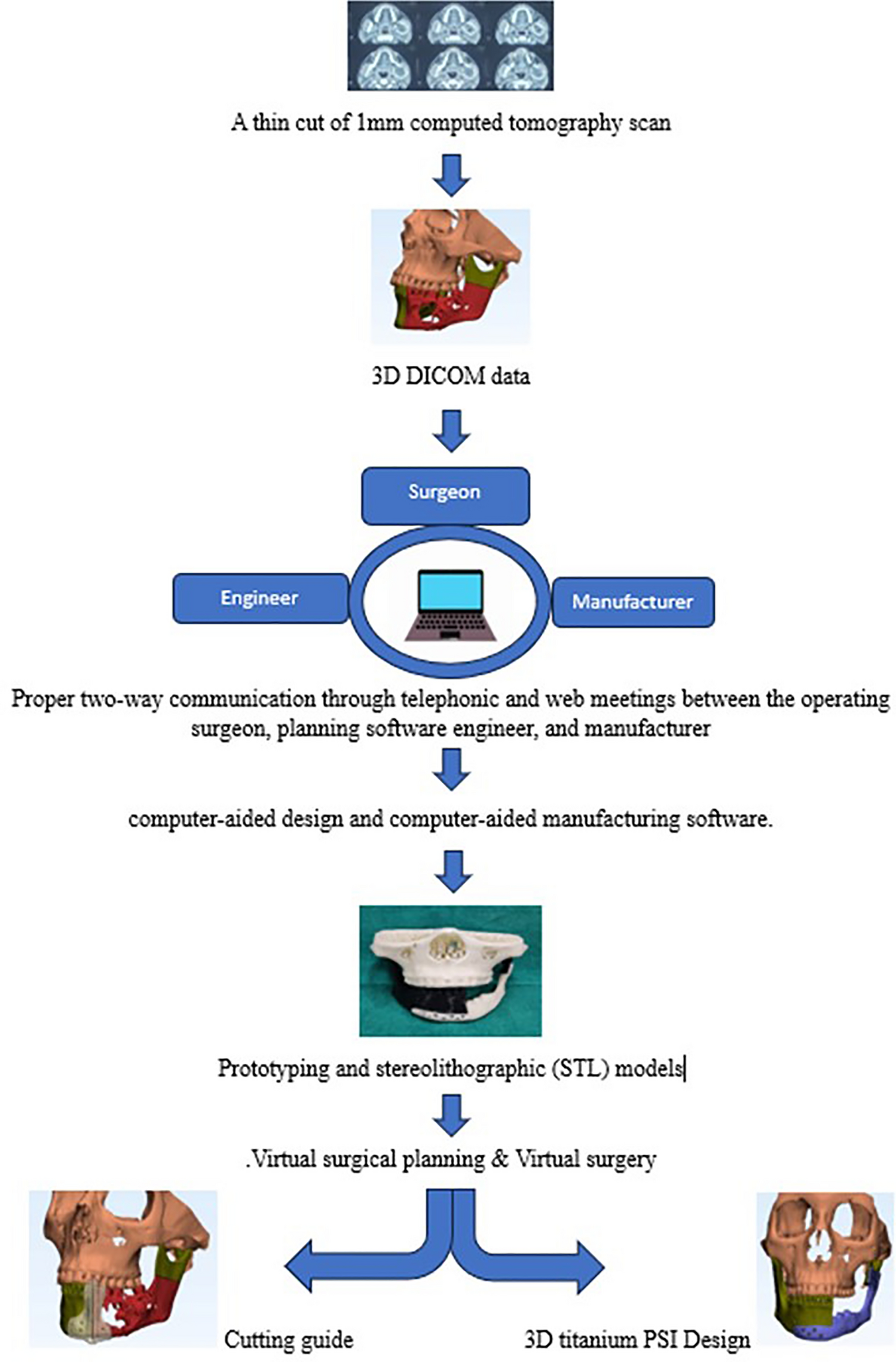 Patient-Specific Three-Dimensional Printed Titanium Implants for Reconstruction of Mandibular Continuity Defects: Pros and Cons