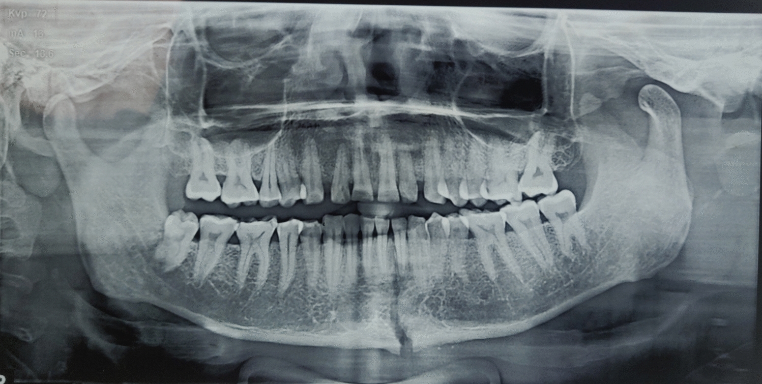 “Condyle First”: A Change in Trend