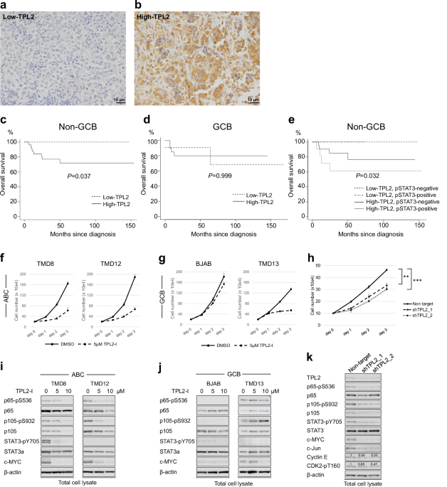 Tumor progression locus 2, a new potential prognostic factor and therapeutic target in activated B-cell-like diffuse large B-cell lymphoma