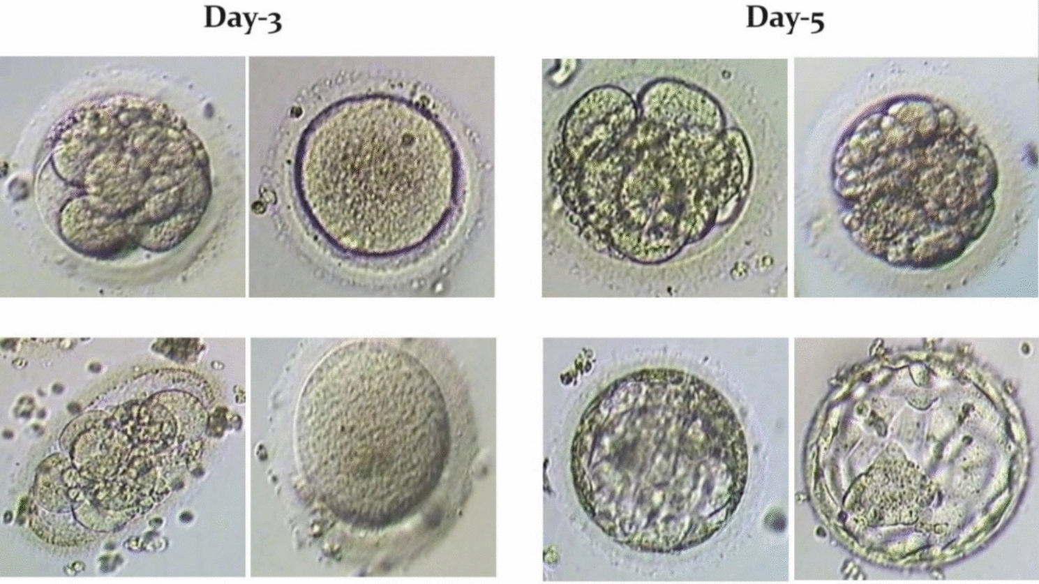 Human Embryo Quality Assessment with Deep Learning Models