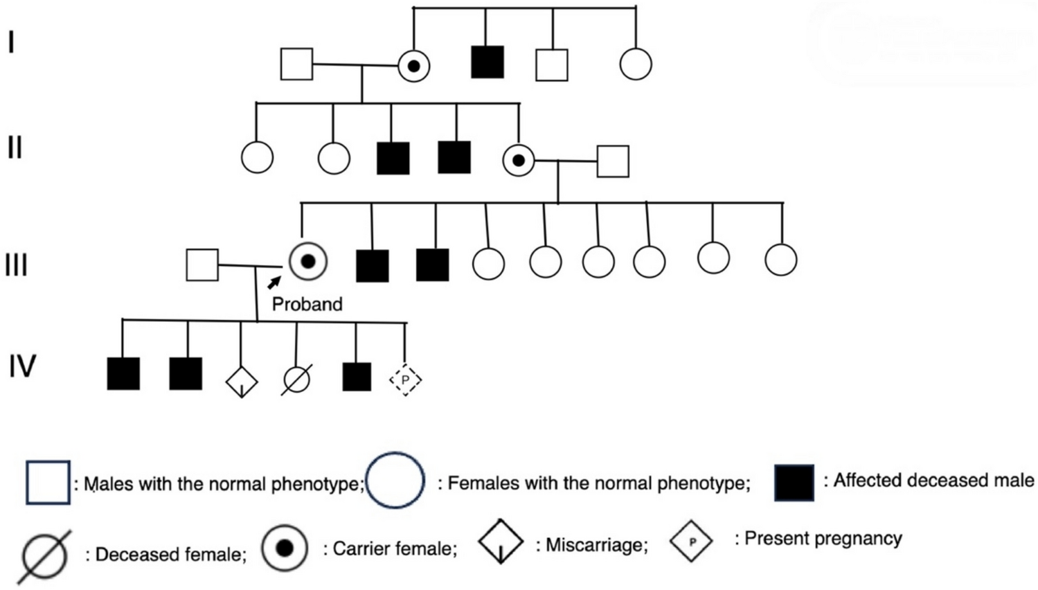 Recurrent Male Neonatal Deaths in a Heterozygous X-linked Ornithine Transcarbamylase Deficiency Carrier Pregnant Woman