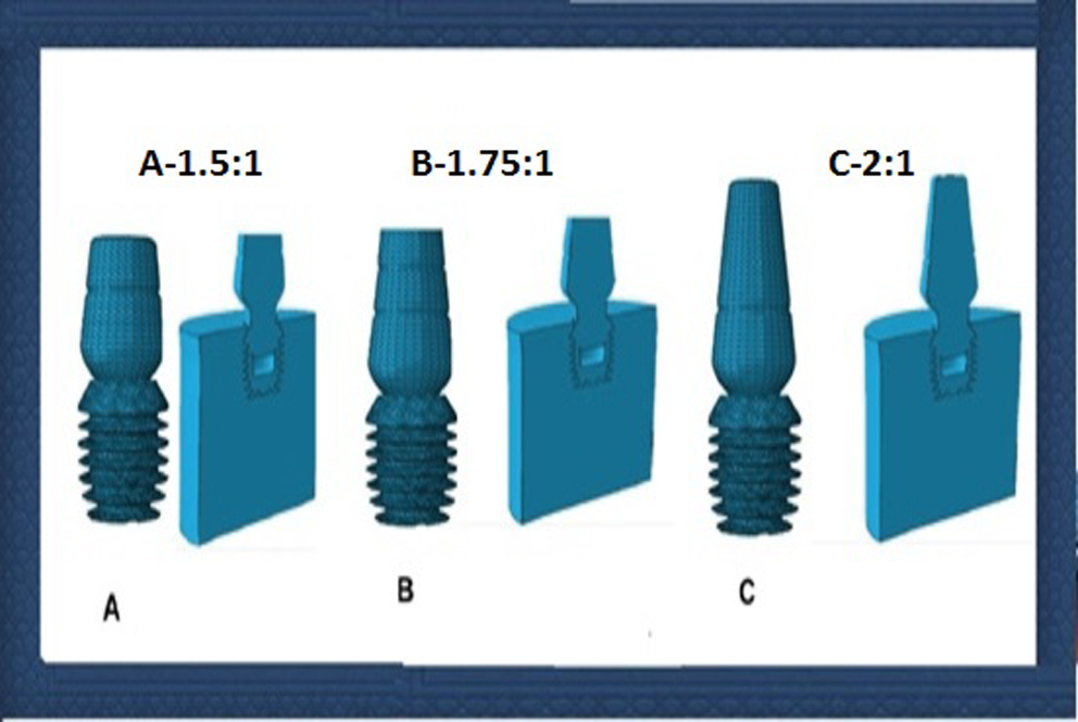 Influence of crown-implant ratio on photofuntcionalized short implants success rates: 5 year follow-up prospective study
