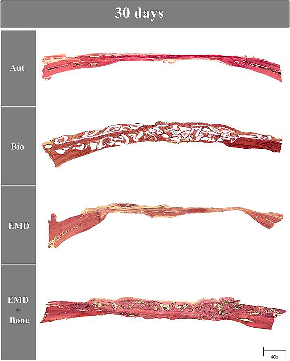 Evaluation of bone regeneration in rat calvaria using combination of enamel matrix derivate and bone graft substitute: a histological, histometric and immunohistochemical study