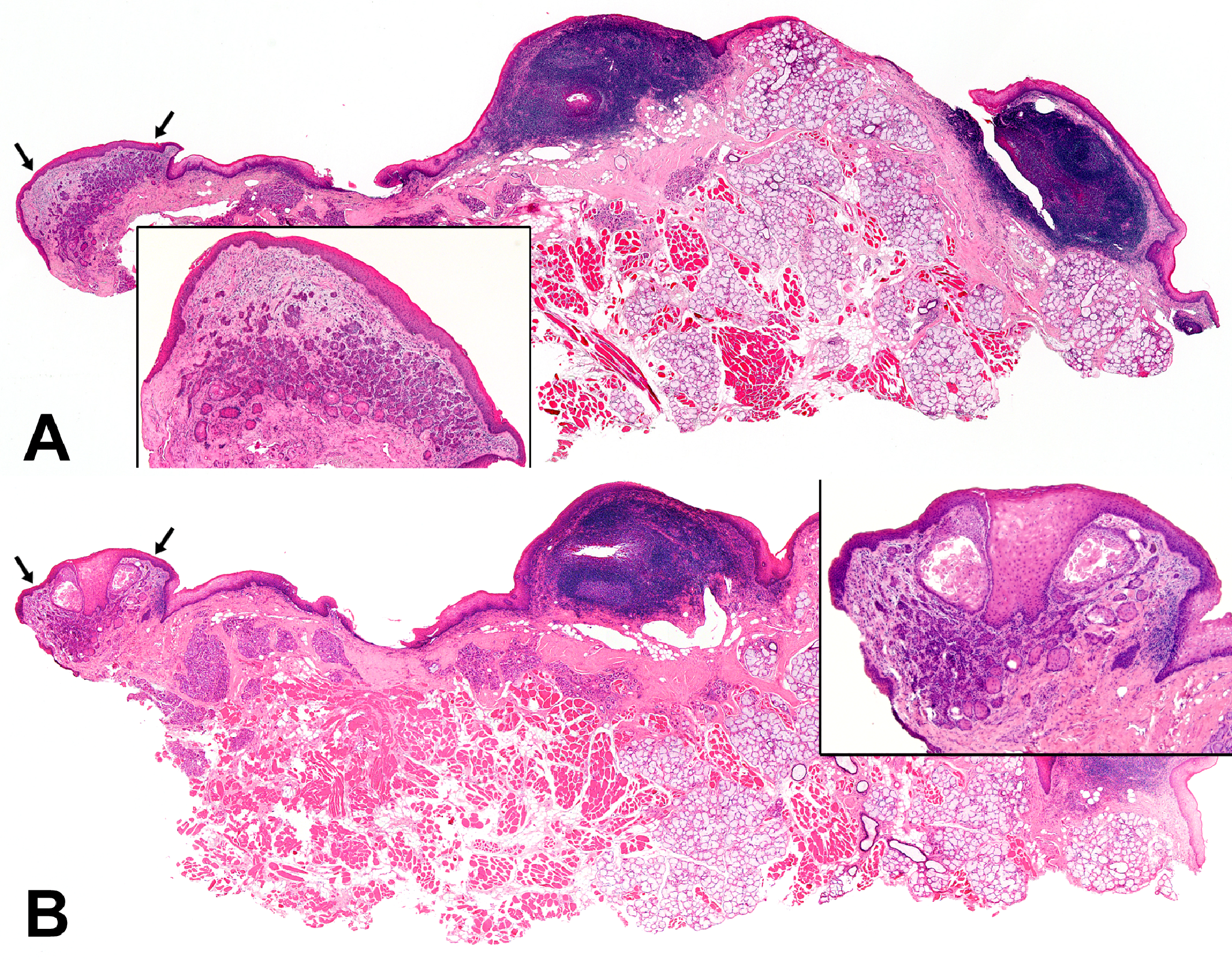 The juxtaoral organ of chievitz in publications about subgemmal neurogenous plaque is a misnomer: time to rename