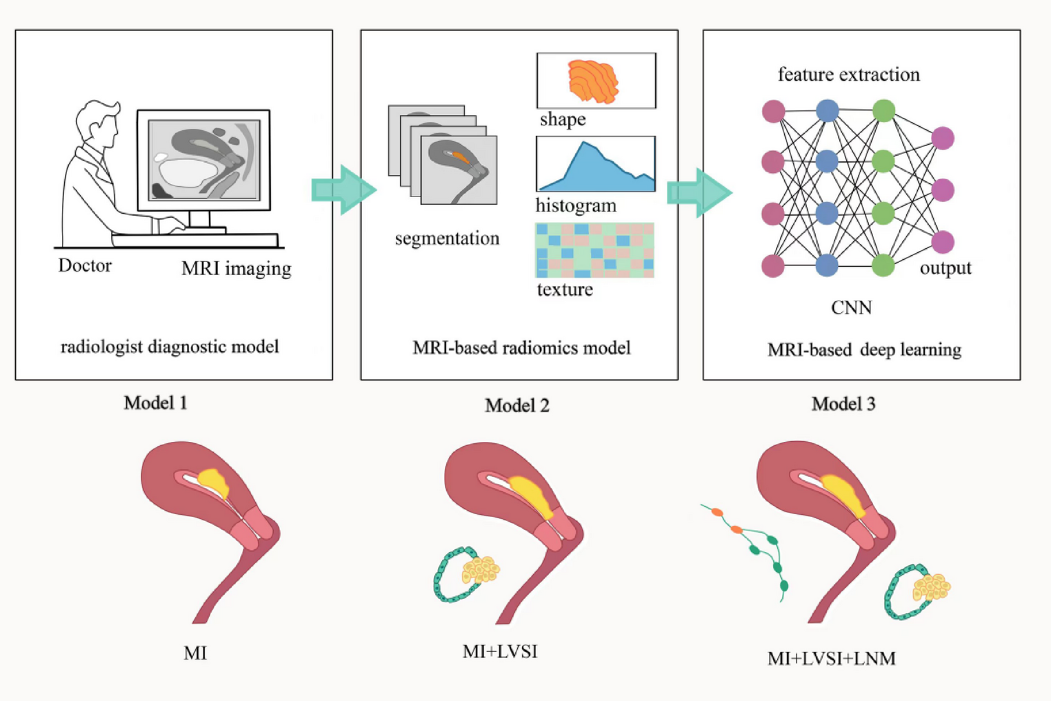 Preoperative risk assessment of invasive endometrial cancer using MRI-based radiomics: a systematic review and meta-analysis