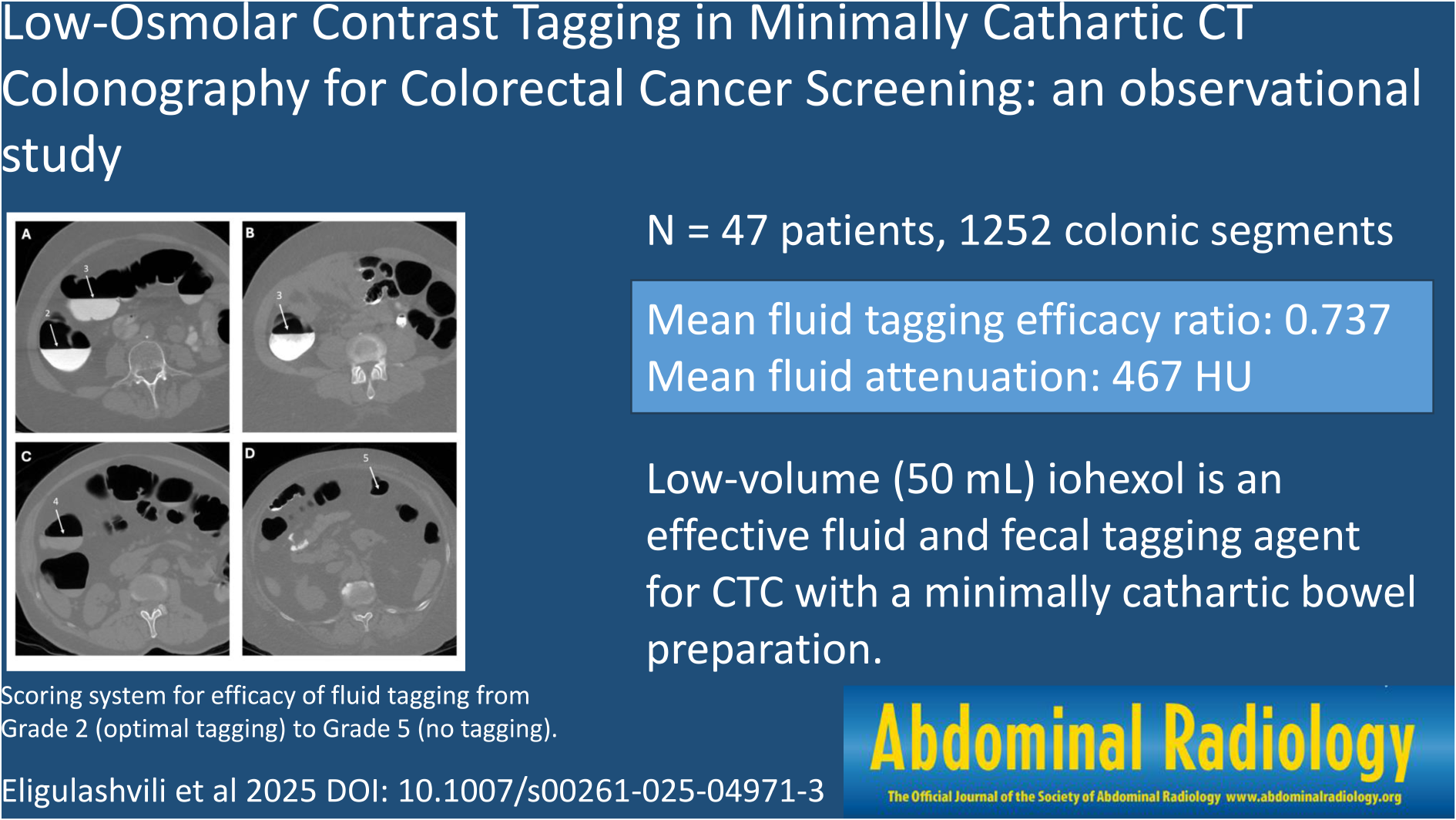 Low-osmolar contrast tagging in minimally cathartic CT colonography for colorectal cancer screening: an observational study