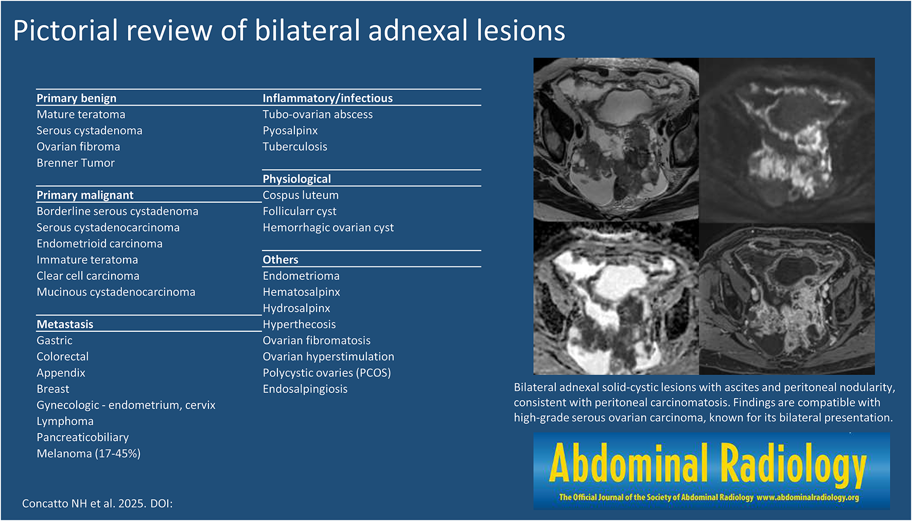 Pictorial review of bilateral adnexal lesions