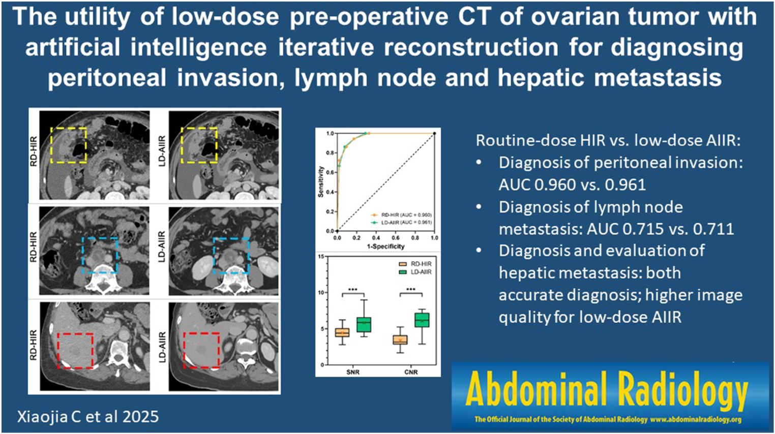The utility of low-dose pre-operative CT of ovarian tumor with artificial intelligence iterative reconstruction for diagnosing peritoneal invasion, lymph node and hepatic metastasis