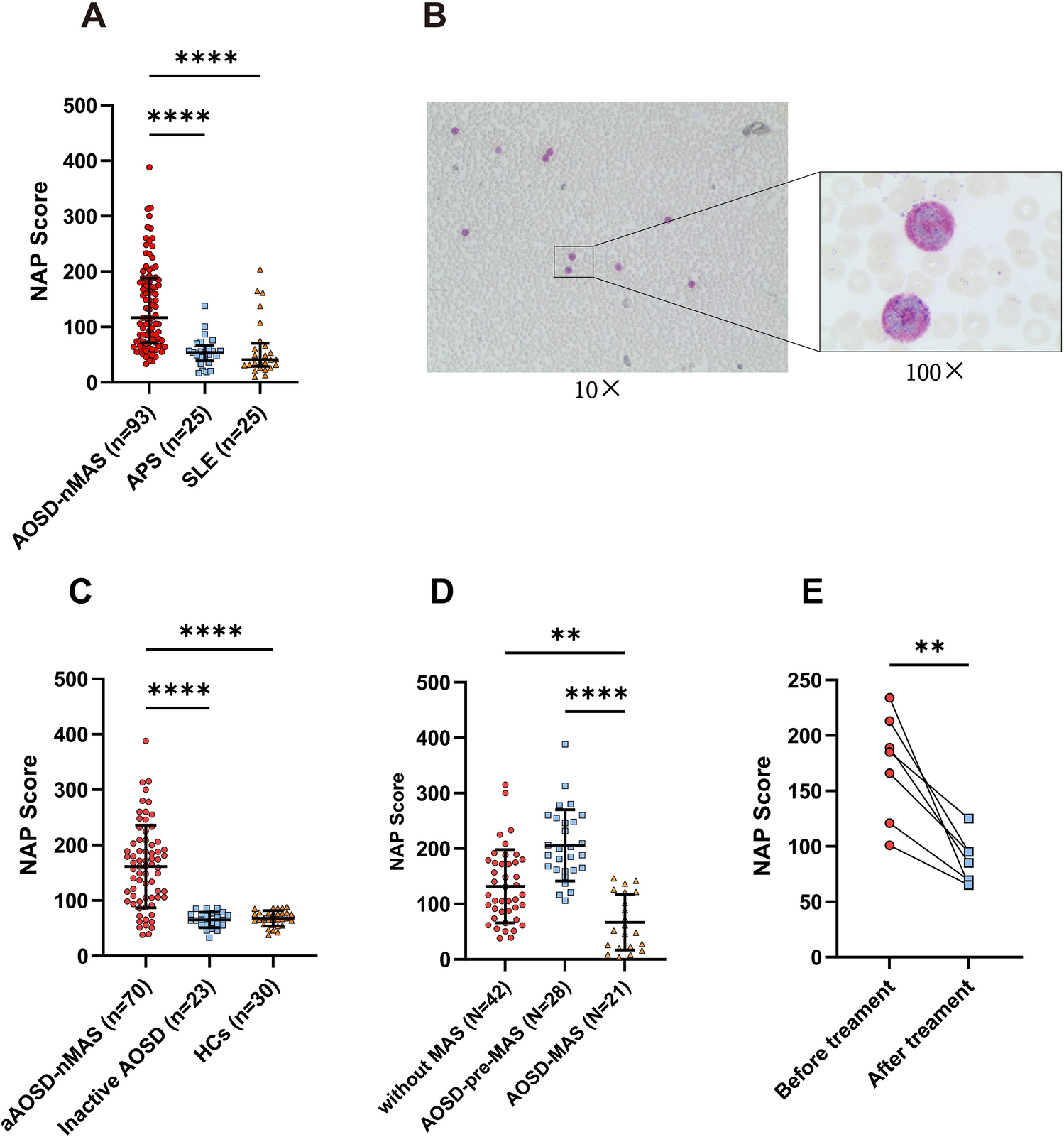 High Neutrophil Alkaline Phosphatase Activity in Adult-Onset Still’s Disease