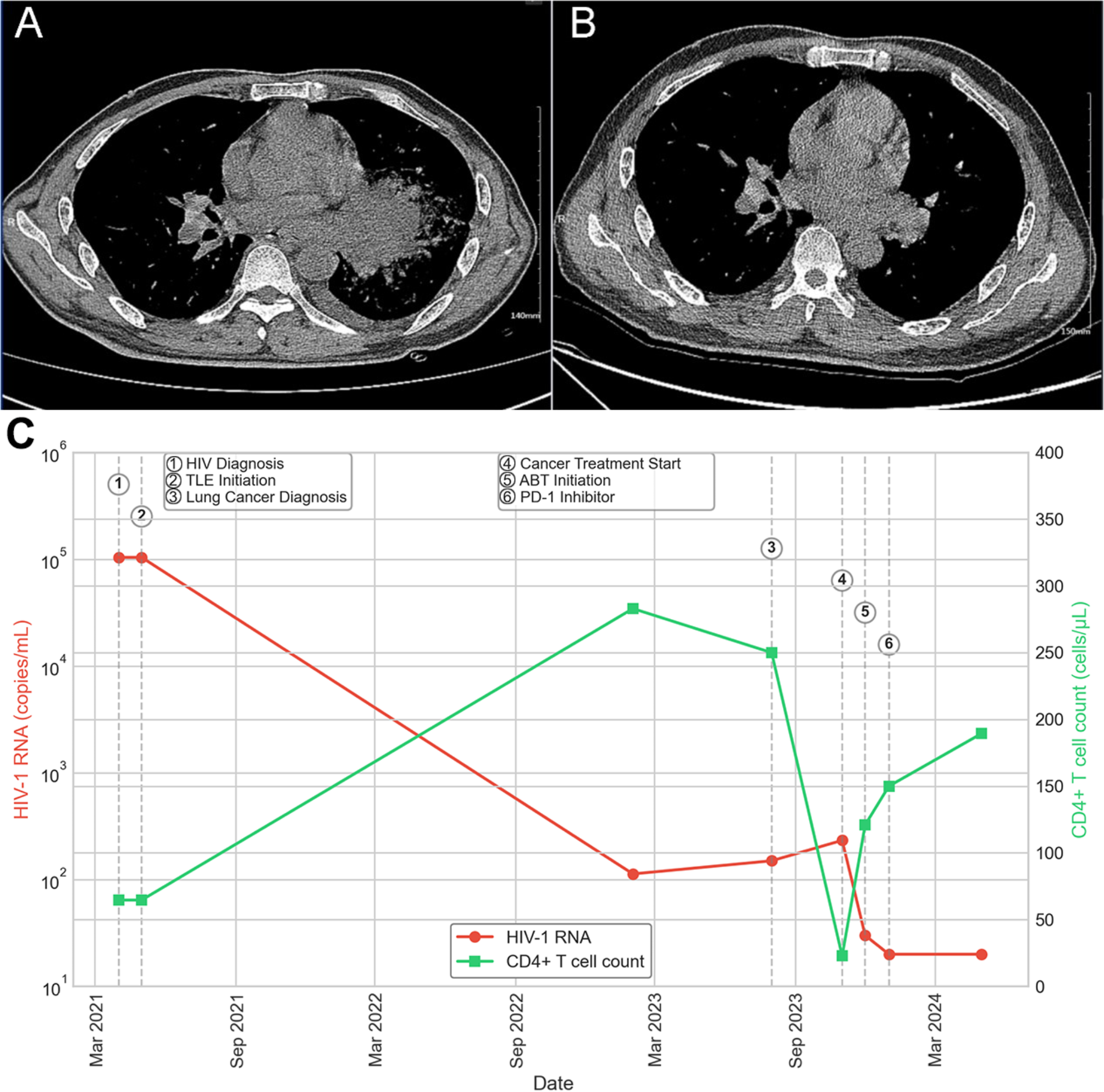 Therapeutic efficacy of albuvirtide-based antiretroviral therapy in people living with HIV who have low-level viremia and non-AIDS-defining malignancies: two case reports