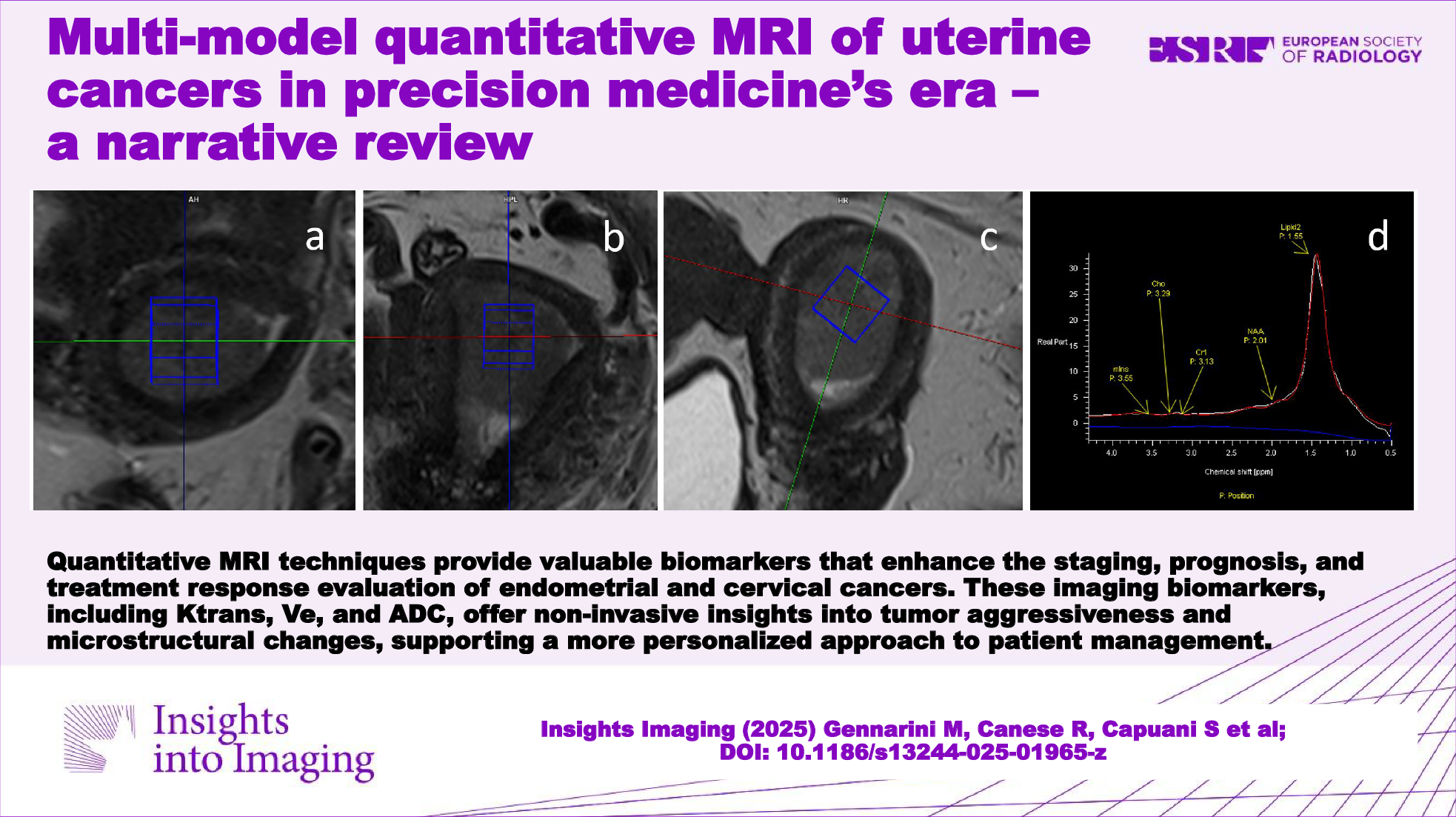 Multi-model quantitative MRI of uterine cancers in precision medicine’s era—a narrative review