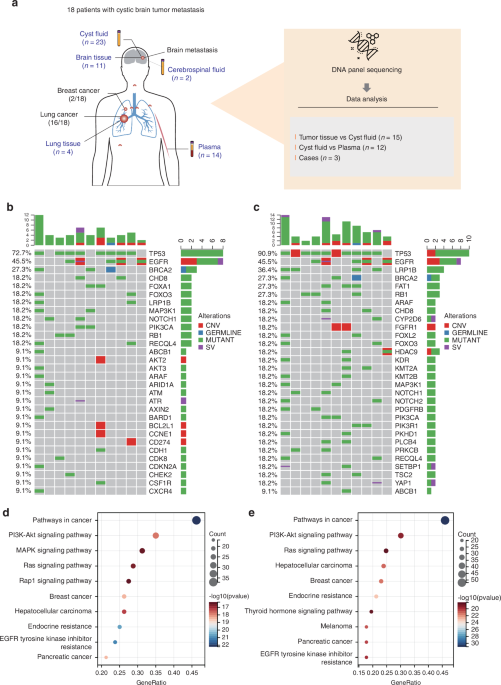 Cyst fluid ctDNA as a biomarker for genetic profiling and treatment monitoring in cystic brain metastases