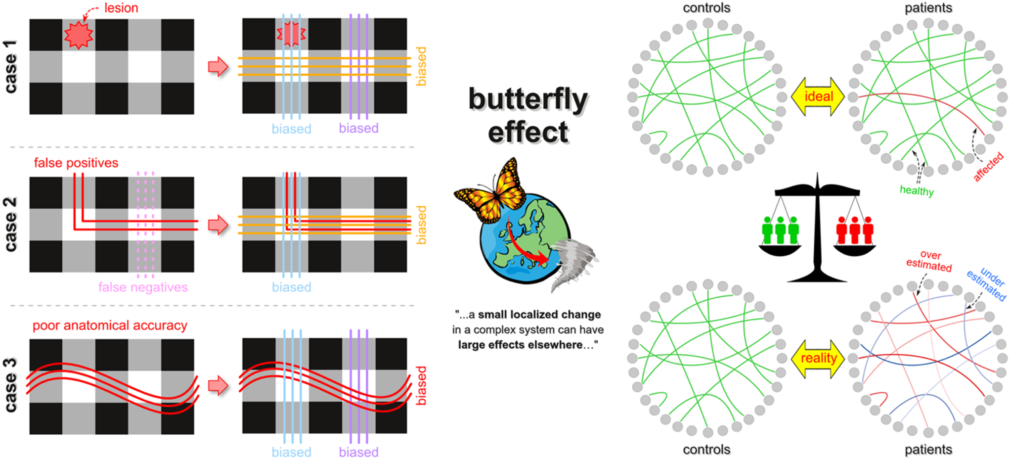 Quantitative tractography: joys and sorrows