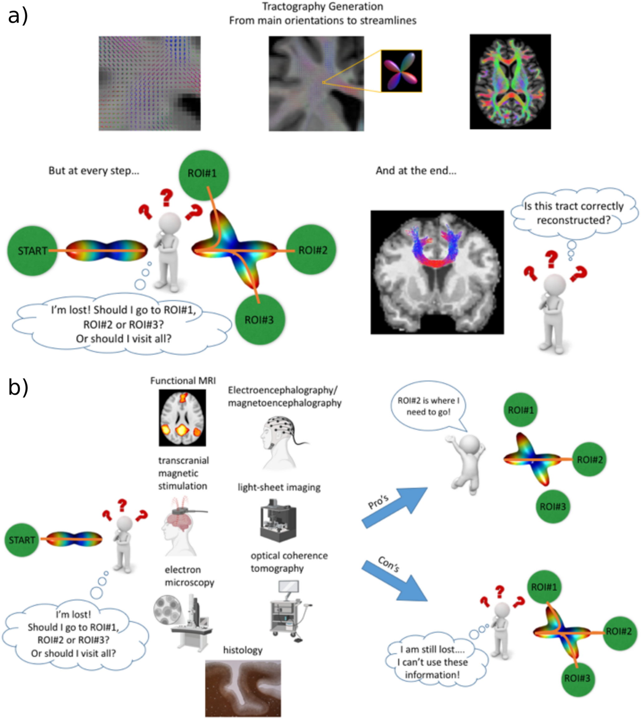 MRI and non-MRI quantifiable neuroanatomical and functional parameters are useful for tractography