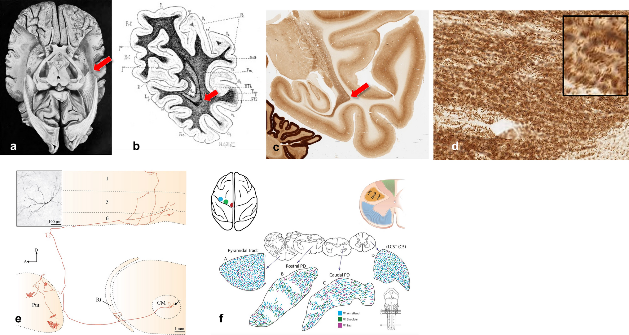 Brain connectivity: complex, not chaotic