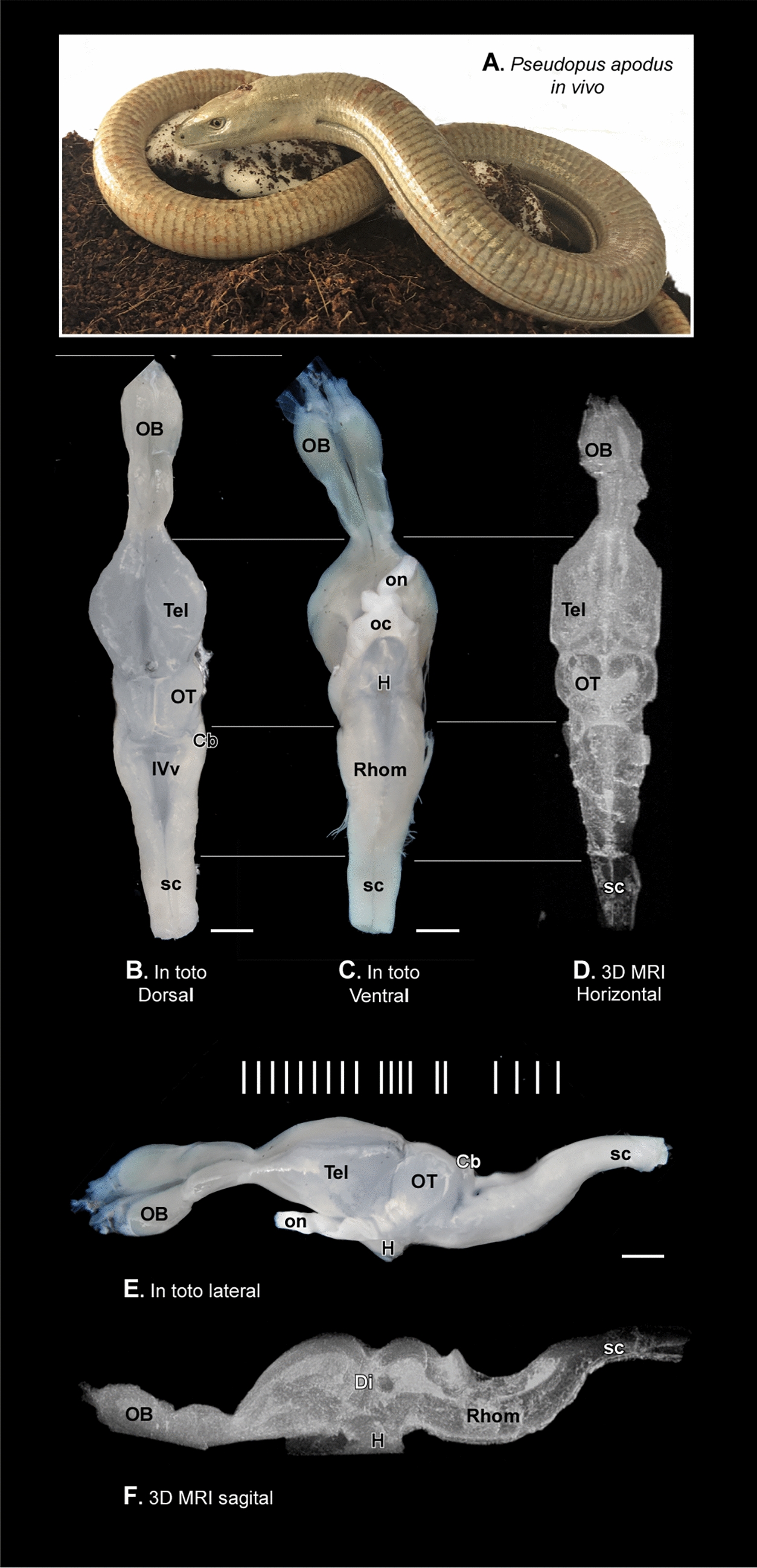 Neuroimaging and immunofluorescence of the  brain: unraveling its structural complexity