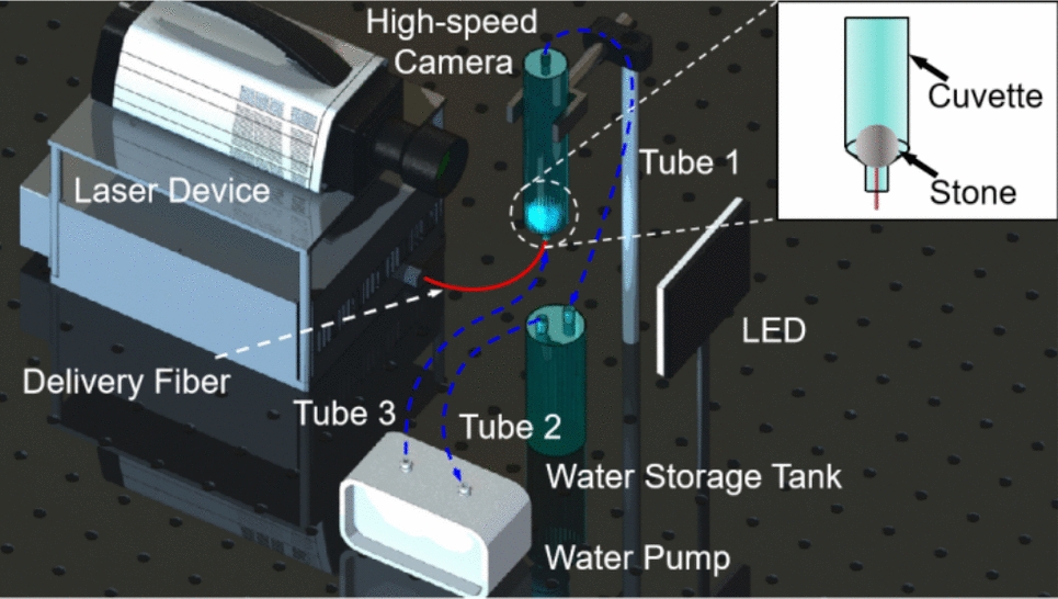 Exploring the influence of laser parameters on retropulsion and ablation rate in thulium fiber laser lithotripsy: an in vitro study