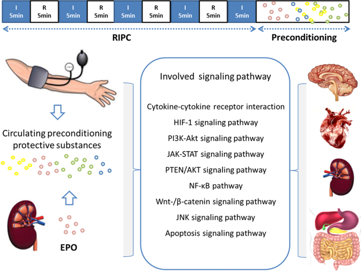 Advances in organ protection: ischemic preconditioning and erythropoietin as protective strategies